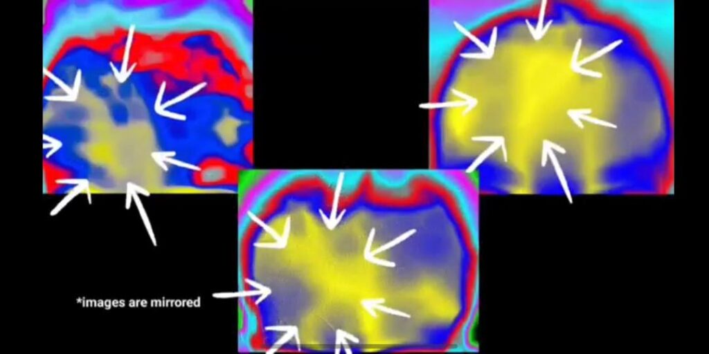 Infrared scans of headbands